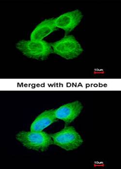 Tubulin alpha 1A antibody