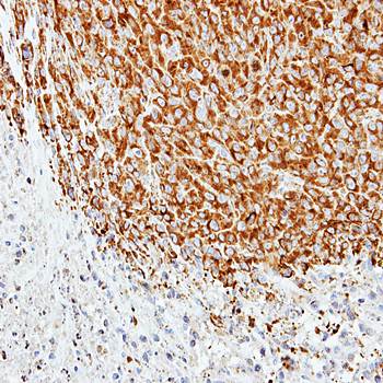 Tubulin alpha 1A antibody