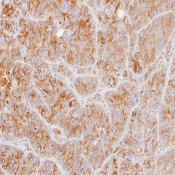Tubulin alphaB antibody