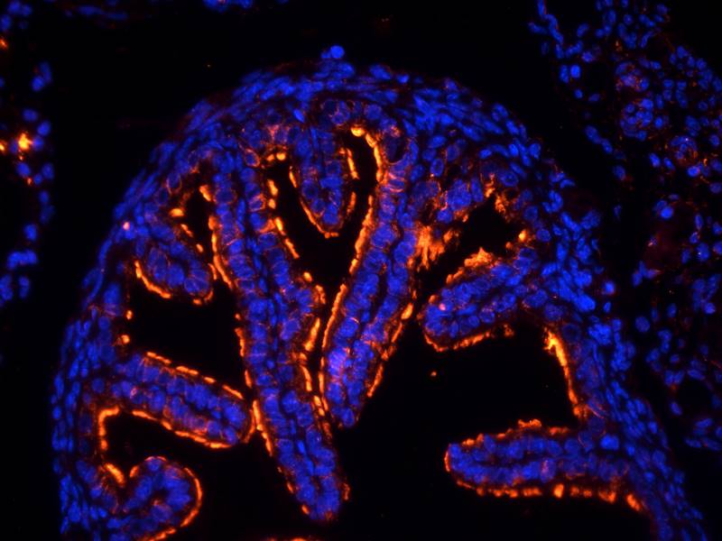 Tubulin beta 3 antibody