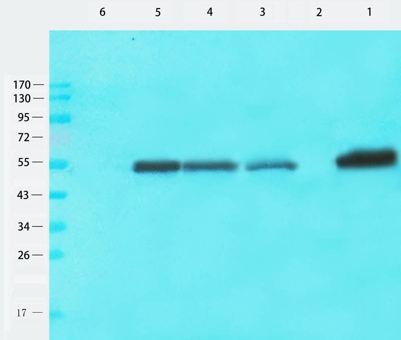 Tubulin beta 3 antibody