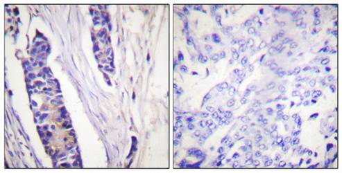 Tubulin β Antibody