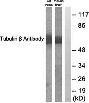 Tubulin β Antibody