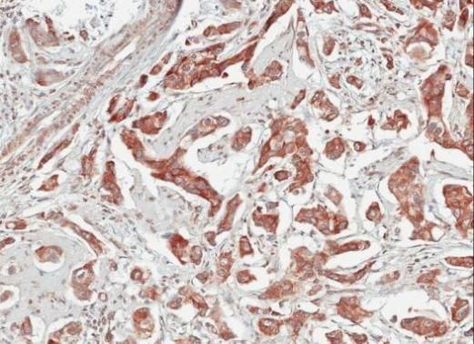 TULP1 antibody [C1C3]