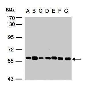 TULP1 antibody