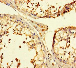 TULP3 Antibody