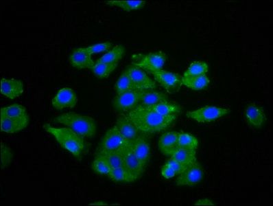 Tumor necrosis factor antibody