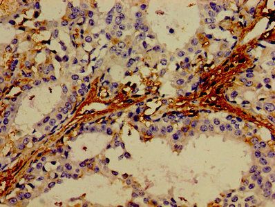 Tumor necrosis factor antibody