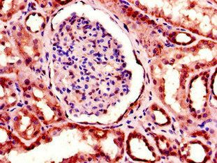Tumor necrosis factor antibody