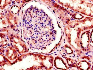 TNF Antibody