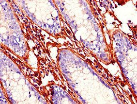 Tumor necrosis factor antibody