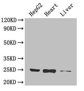 Tumor necrosis factor antibody