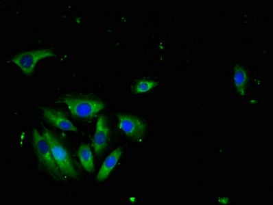 Tumor necrosis factor ligand superfamily member 10 antibody