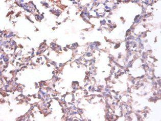 TNFSF10 Antibody
