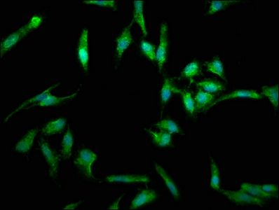 Tumor necrosis factor ligand superfamily member 6 antibody