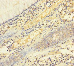 Tumor necrosis factor ligand superfamily member 6 antibody