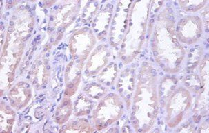 TNFRSF10D Antibody
