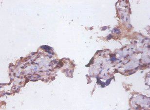 Tumor necrosis factor R superfamily member 6 antibody