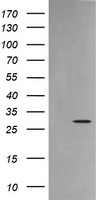 TPD52L3 Antibody
