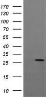 TPD52L3 Antibody