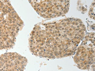 TWIST1 Antibody
