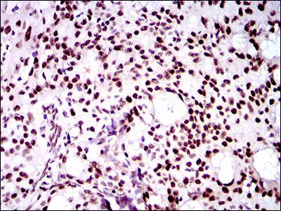 TWIST1 Antibody