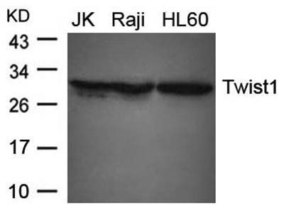 Twist1 Rabbit Polyclonal Antibody