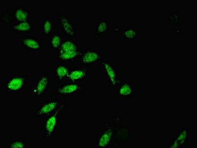 TWIST2 Antibody