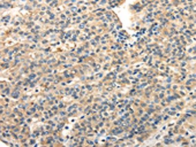 TWIST2 Antibody