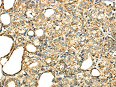 TXN2 Antibody