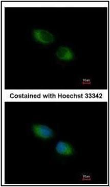 TXNDC1 Rabbit Polyclonal Antibody