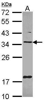TXNDC1 Rabbit Polyclonal Antibody