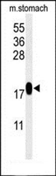 TXNDC12 antibody