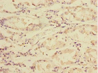 TXNDC5 Antibody