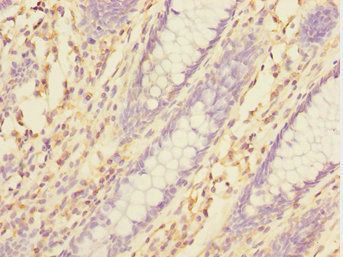 TXNDC5 Antibody