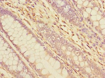 TXNDC5 Antibody