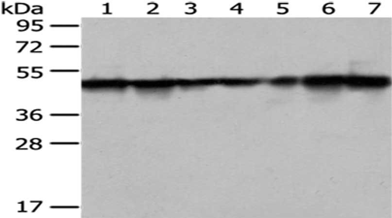 TXNDC5 Antibody