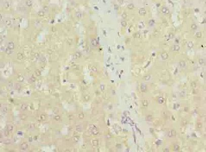 TXNRD1 Antibody