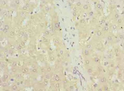 TXNRD1 antibody