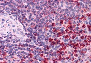 Goat anti-Thioredoxin Reductase 1 Antibody