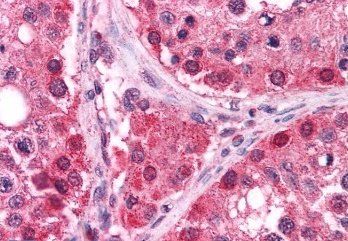 Goat anti-Thioredoxin Reductase 1 Antibody