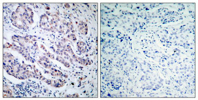 TYK2 (Ab-1054) Antibody