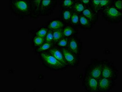 TYK2 Antibody
