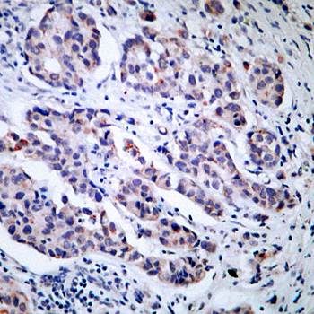 TYK2 (Ab054) Antibody