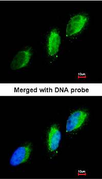 TYK2 antibody