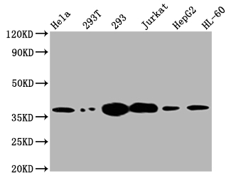 TYMS Antibody
