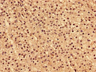 Type I inositol 1, 4, 5-trisphosphate 5-phosphatase antibody