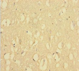 INPP5A Antibody