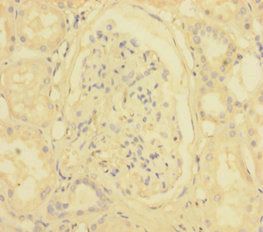INPP5A Antibody
