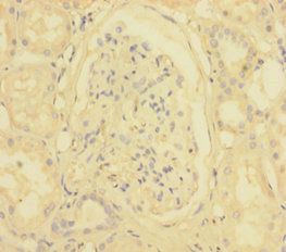 Type I inositol 1, 4, 5-trisphosphate 5-phosphatase antibody